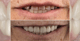 Slider image (8) CHC Clinica Dental in Barcelona Spain
